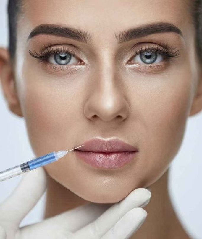 Fumei hyaluronic acid dermal filler 1ml for face application